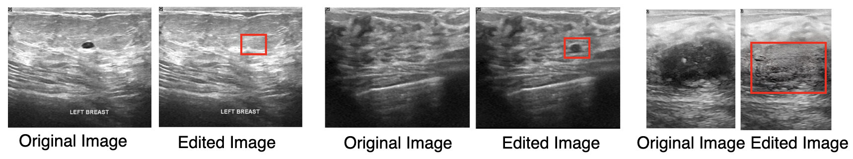 Image Editing (Medical)