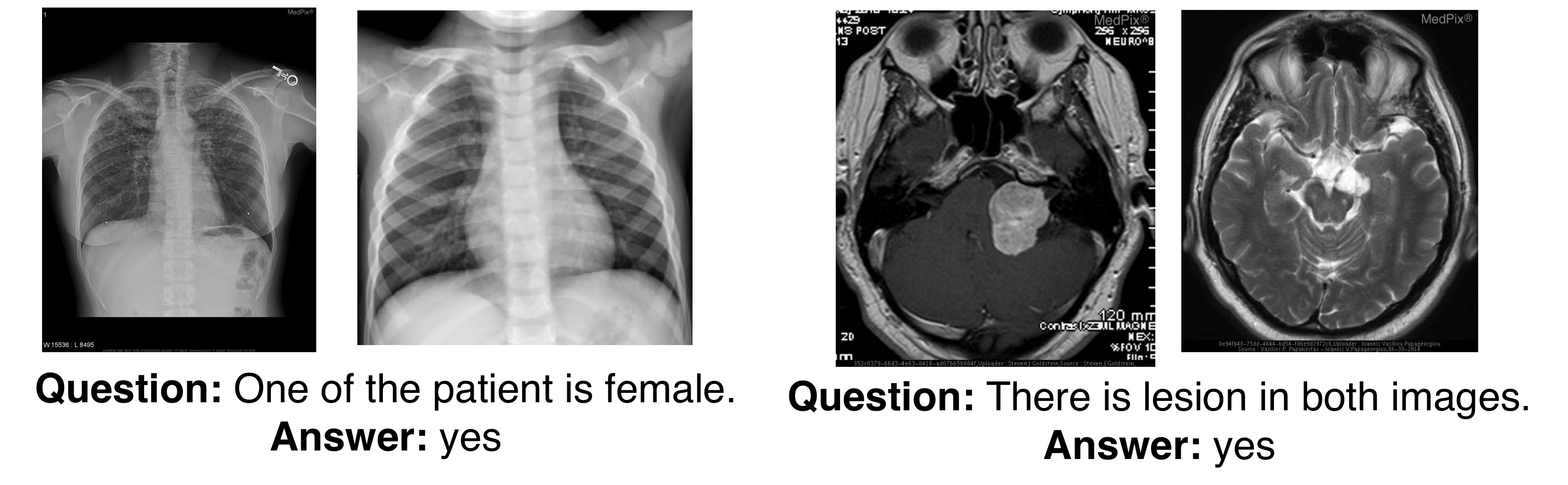 Image Pair Reasoning