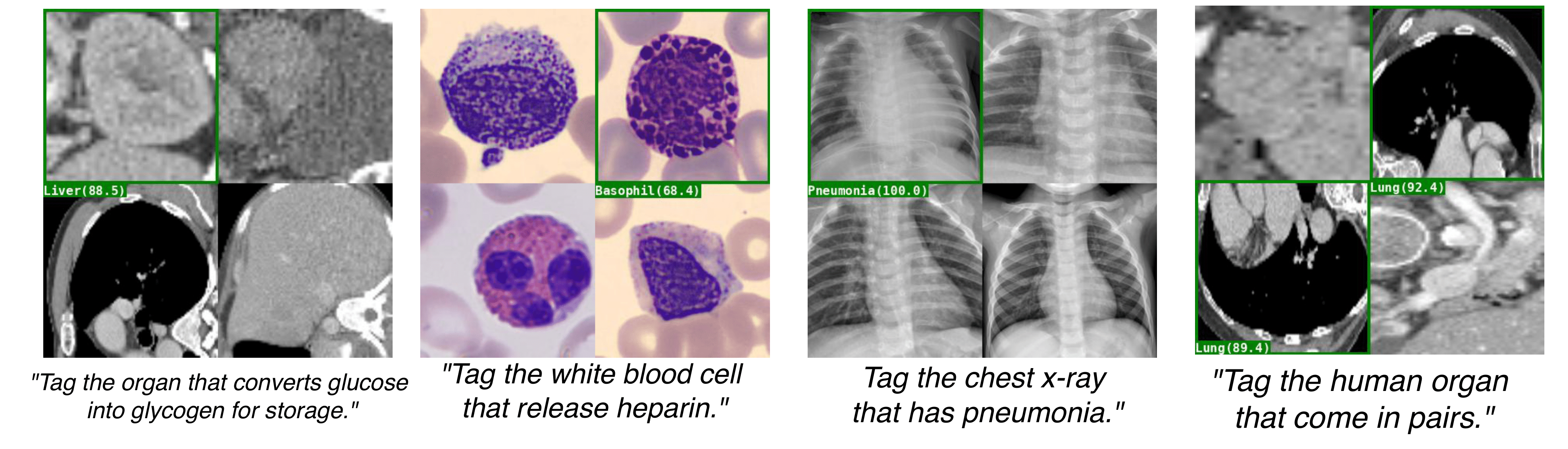 Knowledge Tagging (Medical)